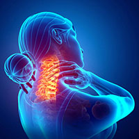 por qué sufro dolor cervical